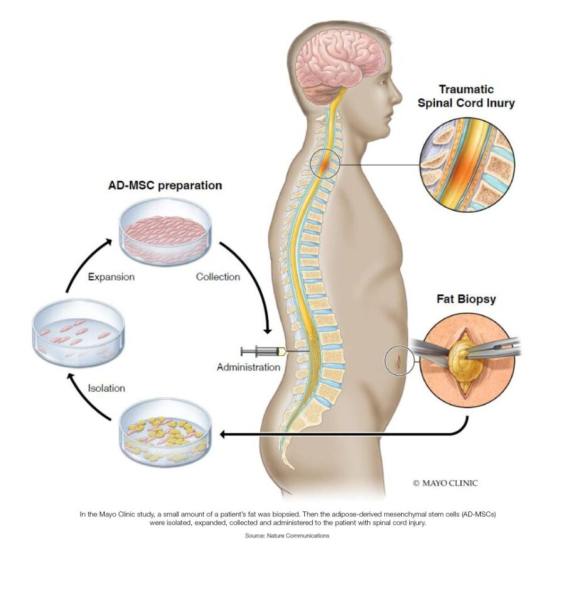 Стволовые клетки: новый экспериментальный метод лечения повреждений спинного мозга