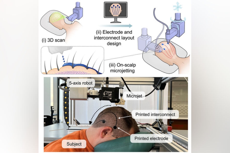CBM: разработаны временные гибкие электроды, наносящиеся на кожу 3D-принтером